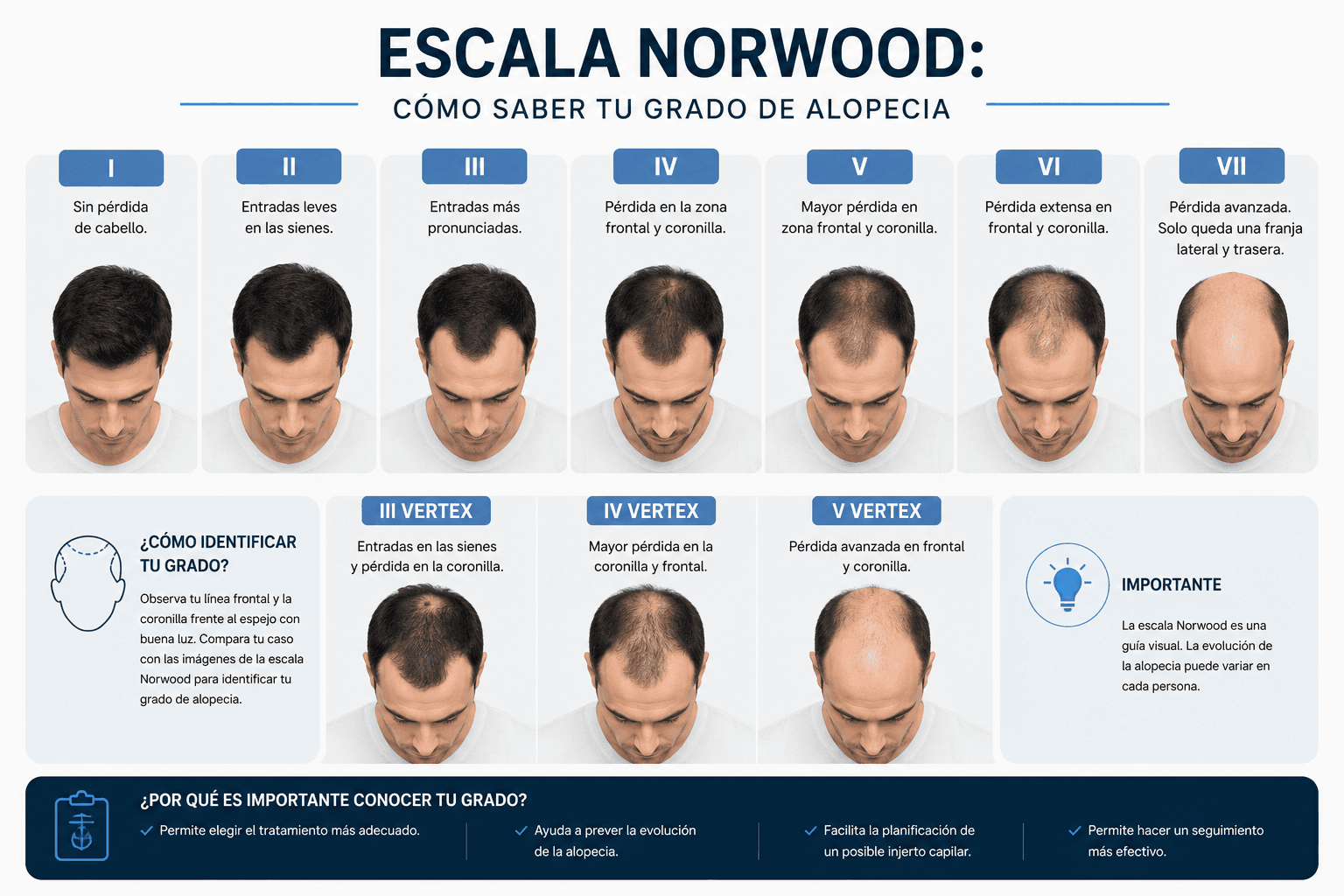 Imagen de apoyo para Escala Norwood: cómo saber tu grado de alopecia