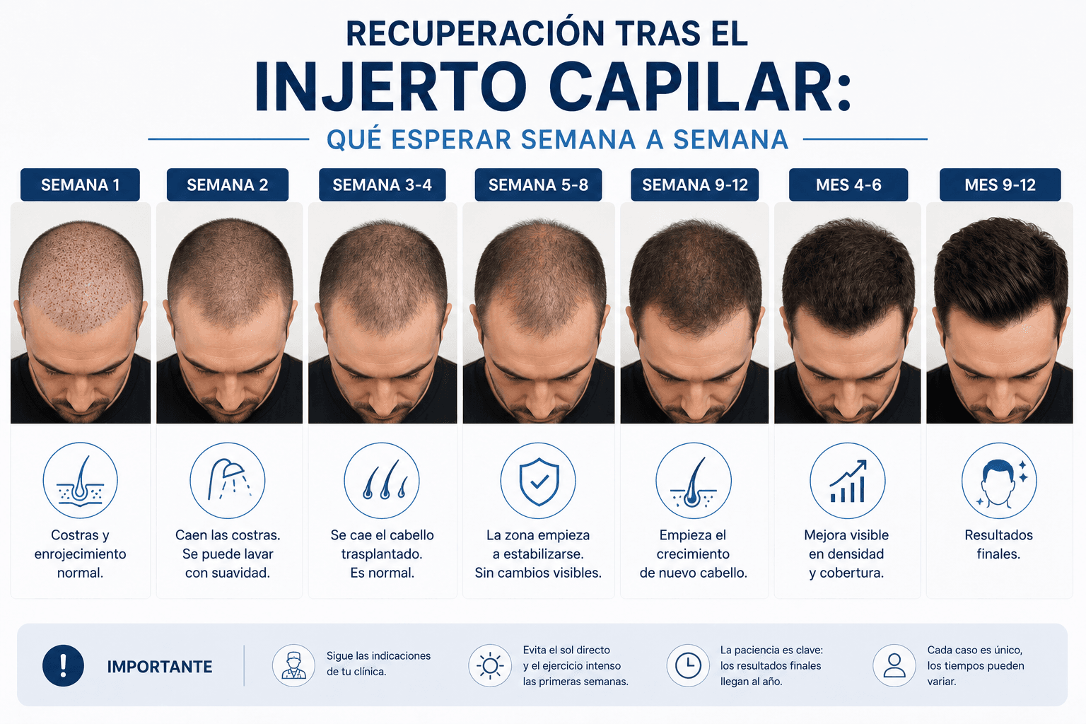 Imagen de apoyo para Recuperación tras el injerto capilar: qué esperar semana a semana
